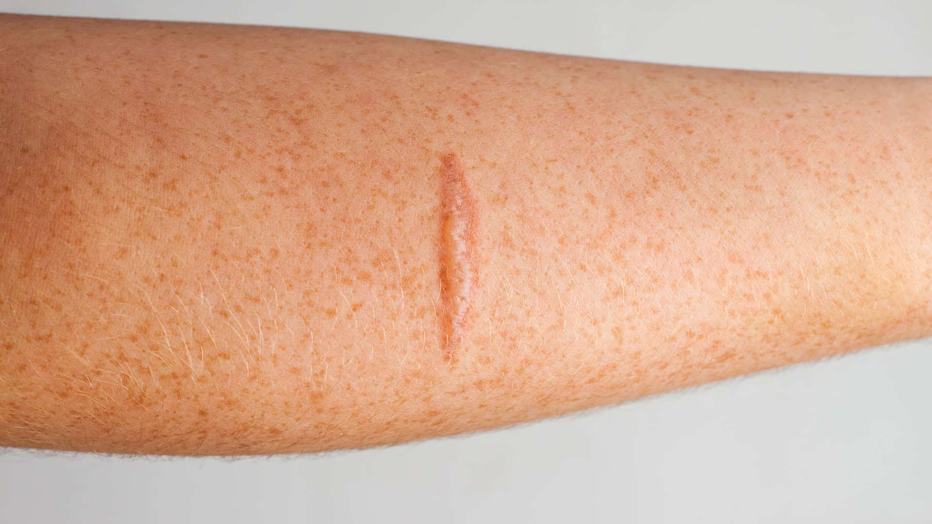 Image of Scars