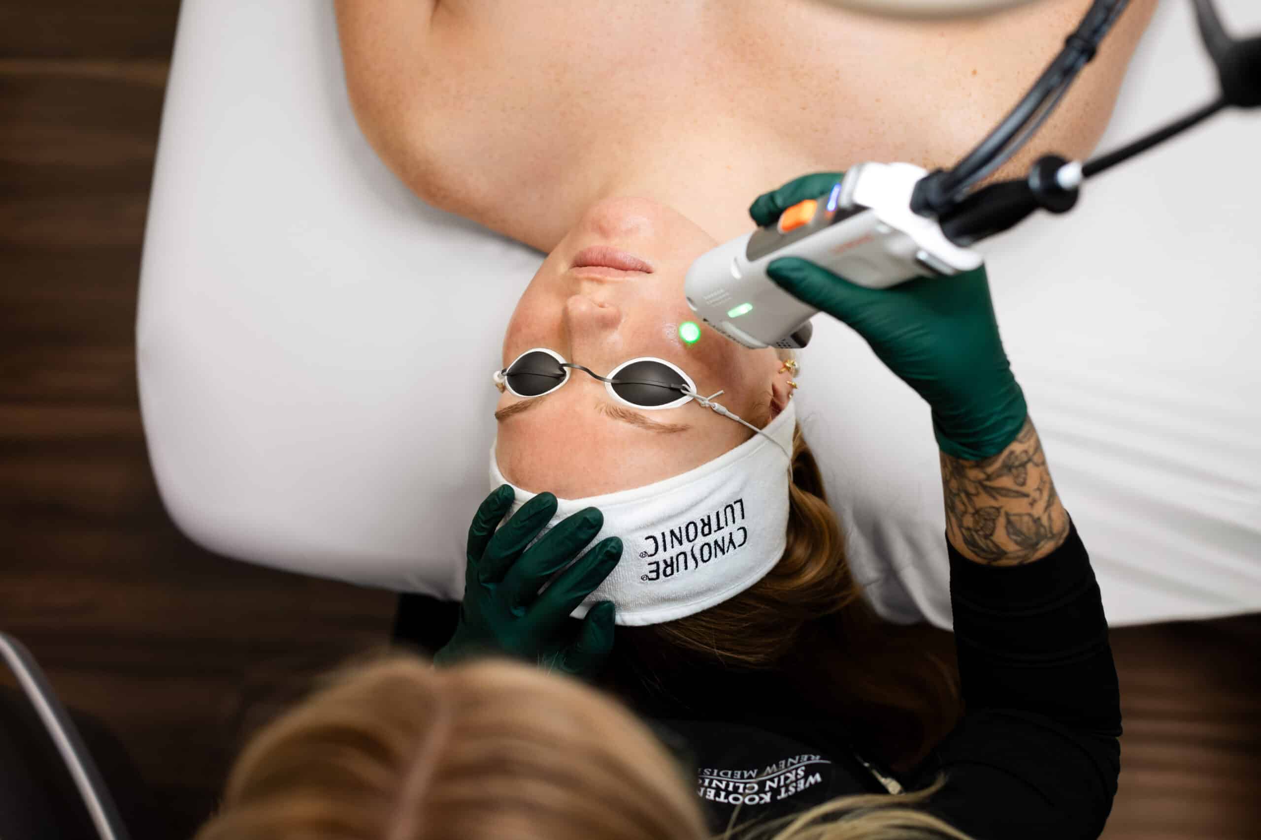 Image of Laser Skin Rejuvenation